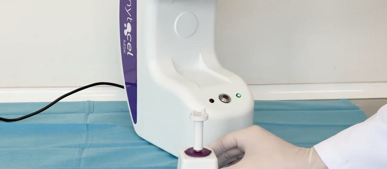 A clinician’s gloved hands placing a single-use cartridge into the processing unit on a sterile drape