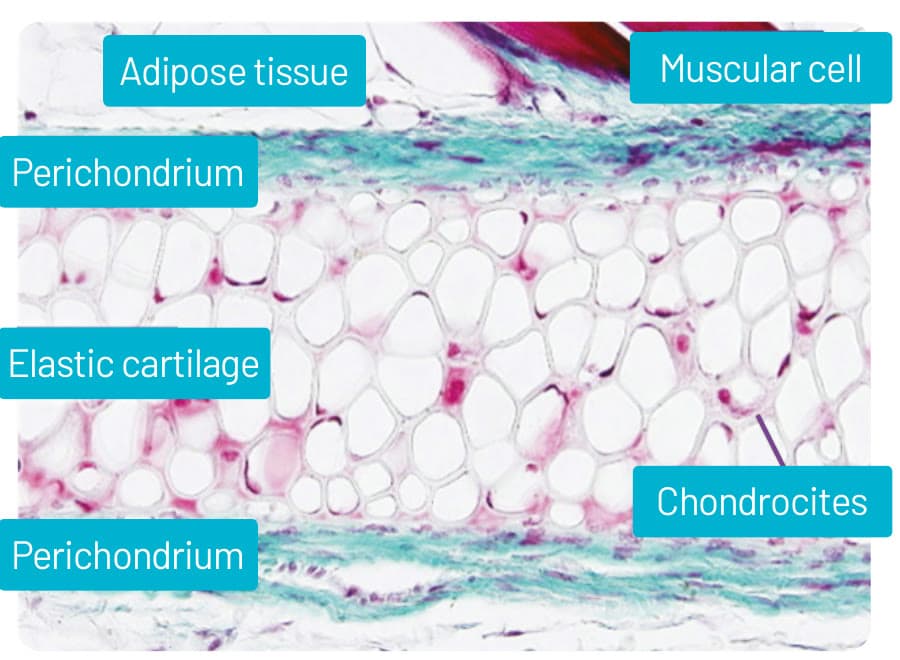 Labelled histology section of auricular cartilage showing perichondrium, elastic cartilage and chondrocytes